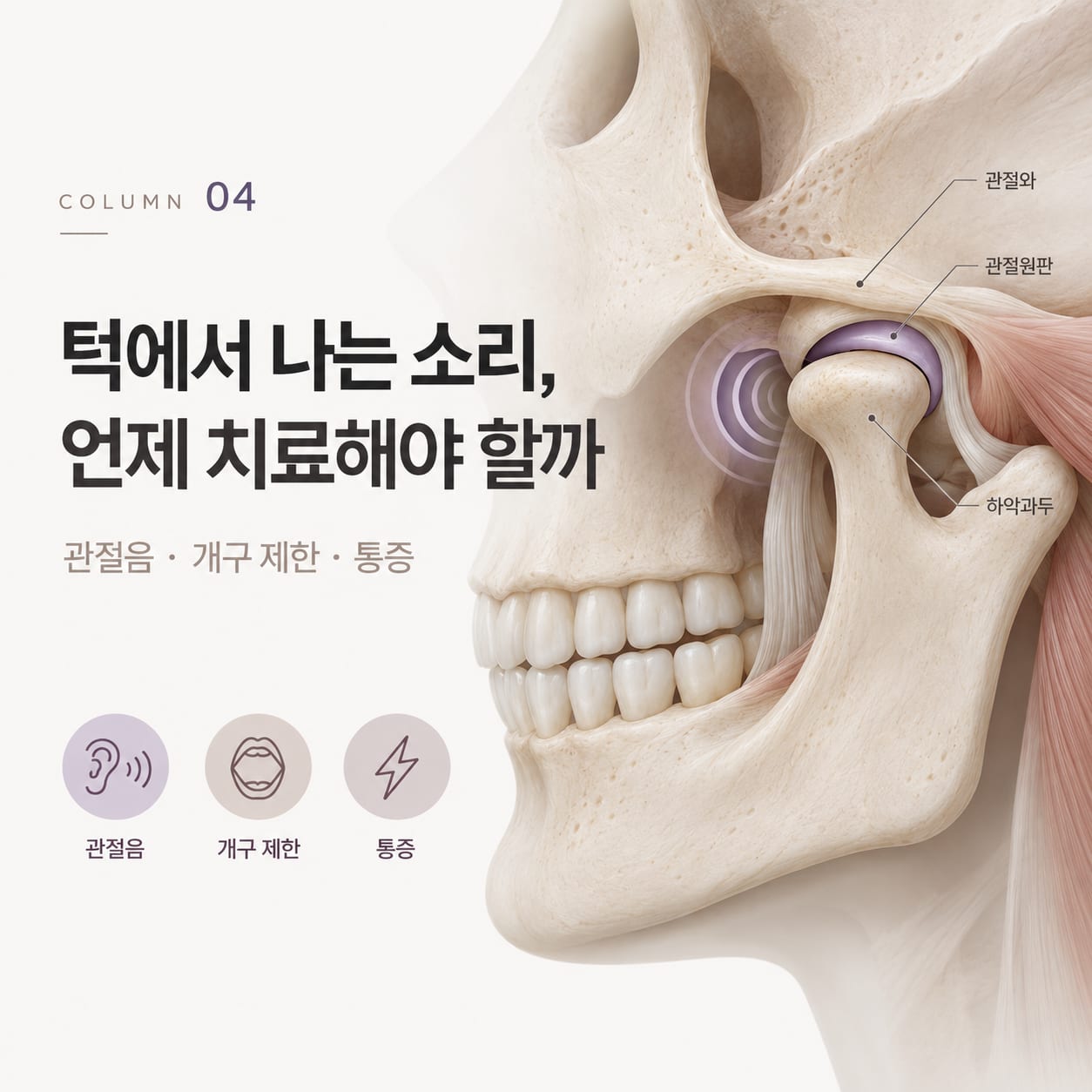 측두하악관절의 관절와, 관절원판, 하악과두 구조와 관절음·개구 제한·통증 세 가지 증상을 표시한 그림