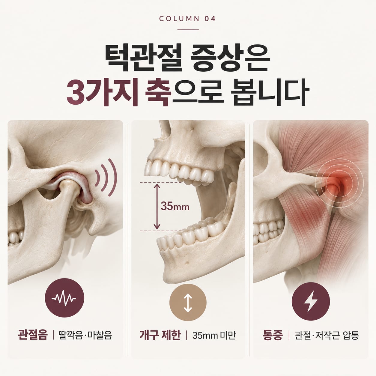 턱관절 증상의 세 가지 축 — 관절음, 최대 개구 35mm 미만의 개구 제한, 관절·저작근 압통 비교 그림
