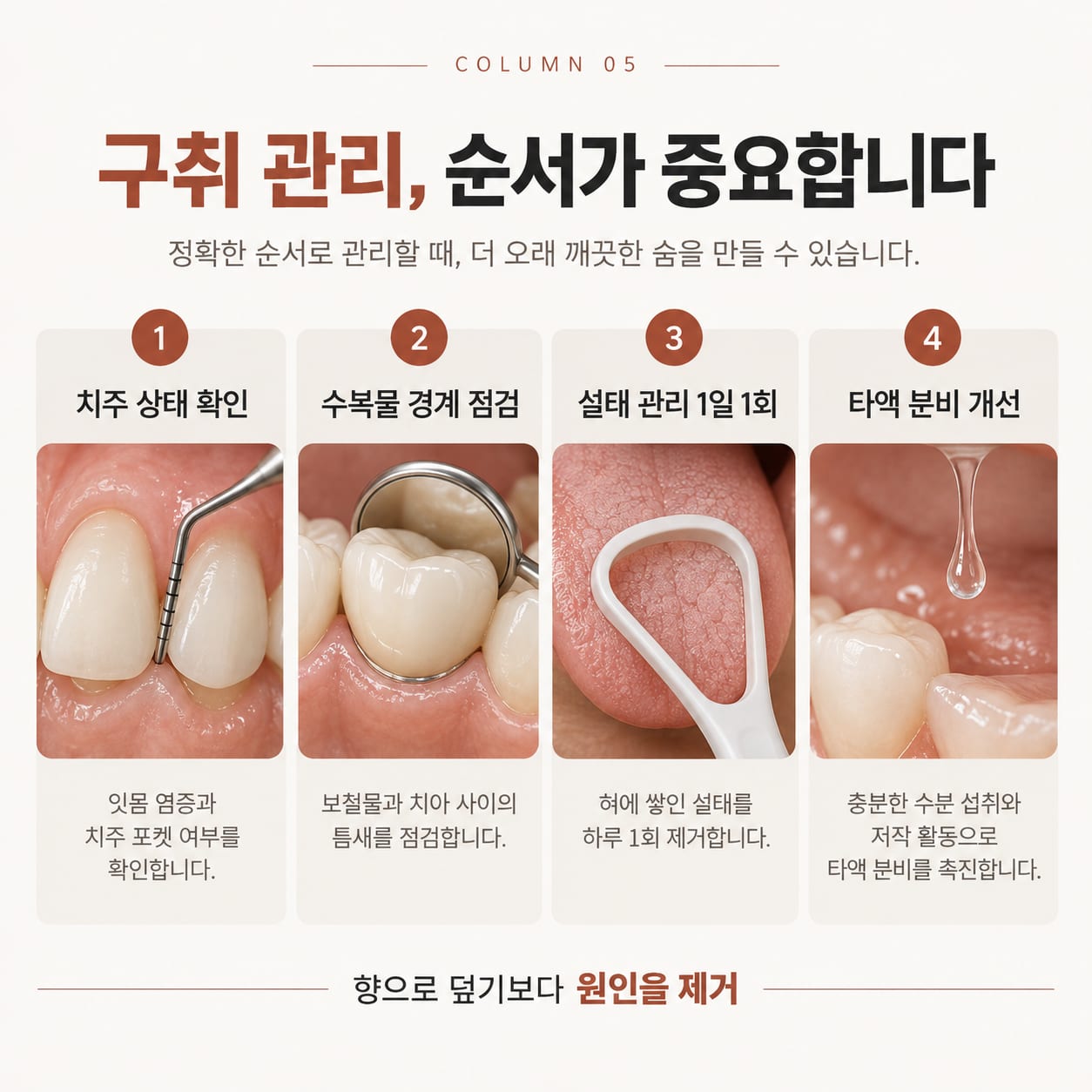 치주 상태 확인, 수복물 경계 점검, 1일 1회 설태 관리, 타액 분비 개선으로 이어지는 구취 관리 4단계 그림