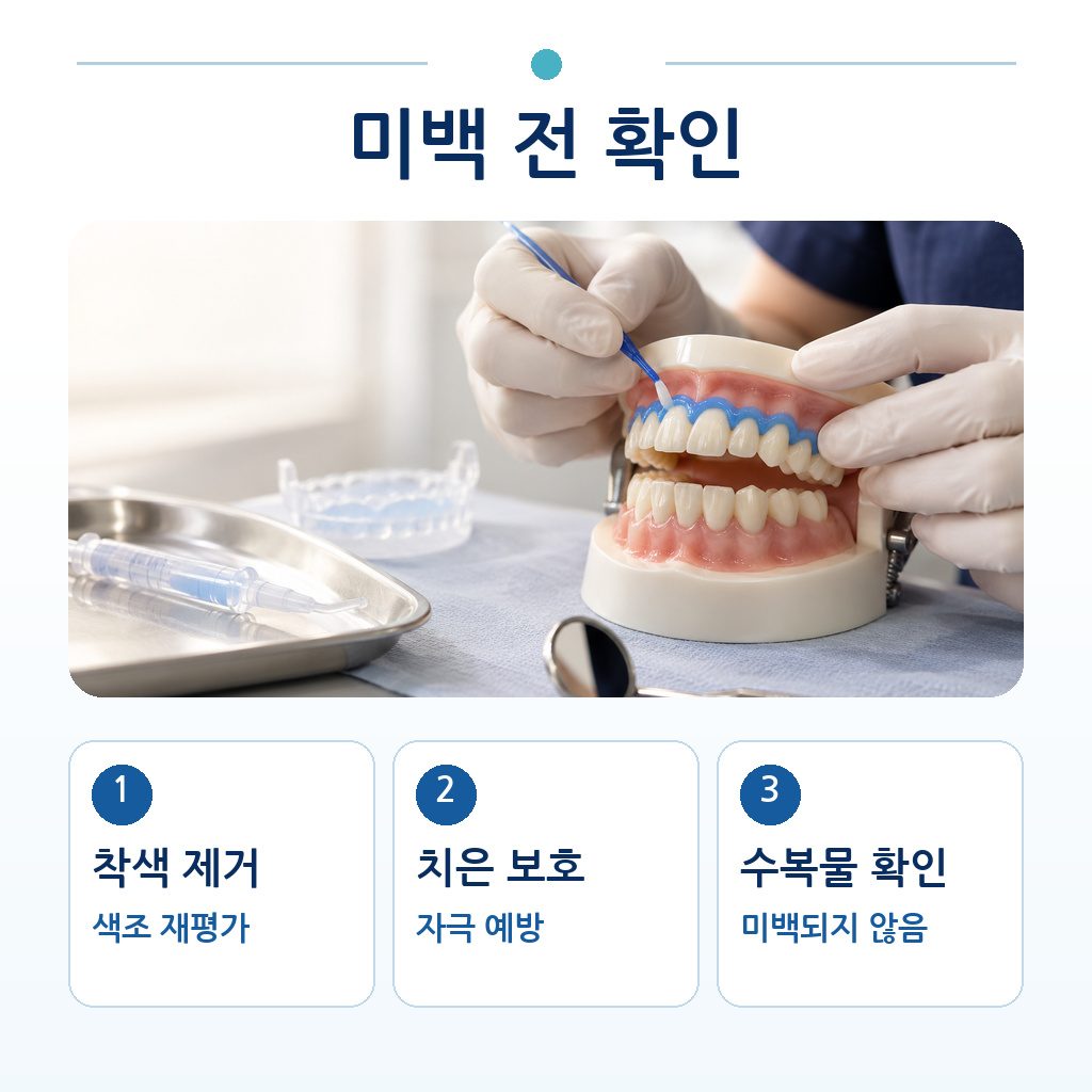 미백 전 착색 제거, 치은 보호, 수복물 확인 세 가지 준비 과정을 보여 주는 그림