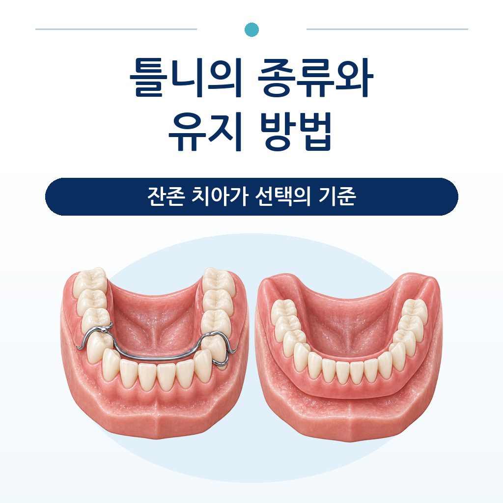 부분틀니와 완전틀니를 나란히 놓고 유지 방식의 차이를 보여 주는 그림