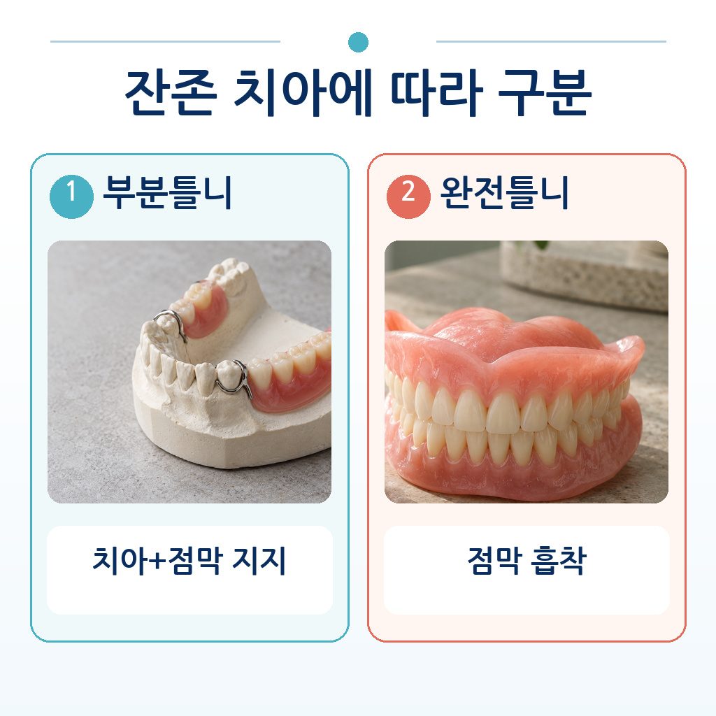 잔존 치아에 클라스프를 거는 부분틀니와 점막 흡착으로 유지되는 완전틀니를 비교한 그림