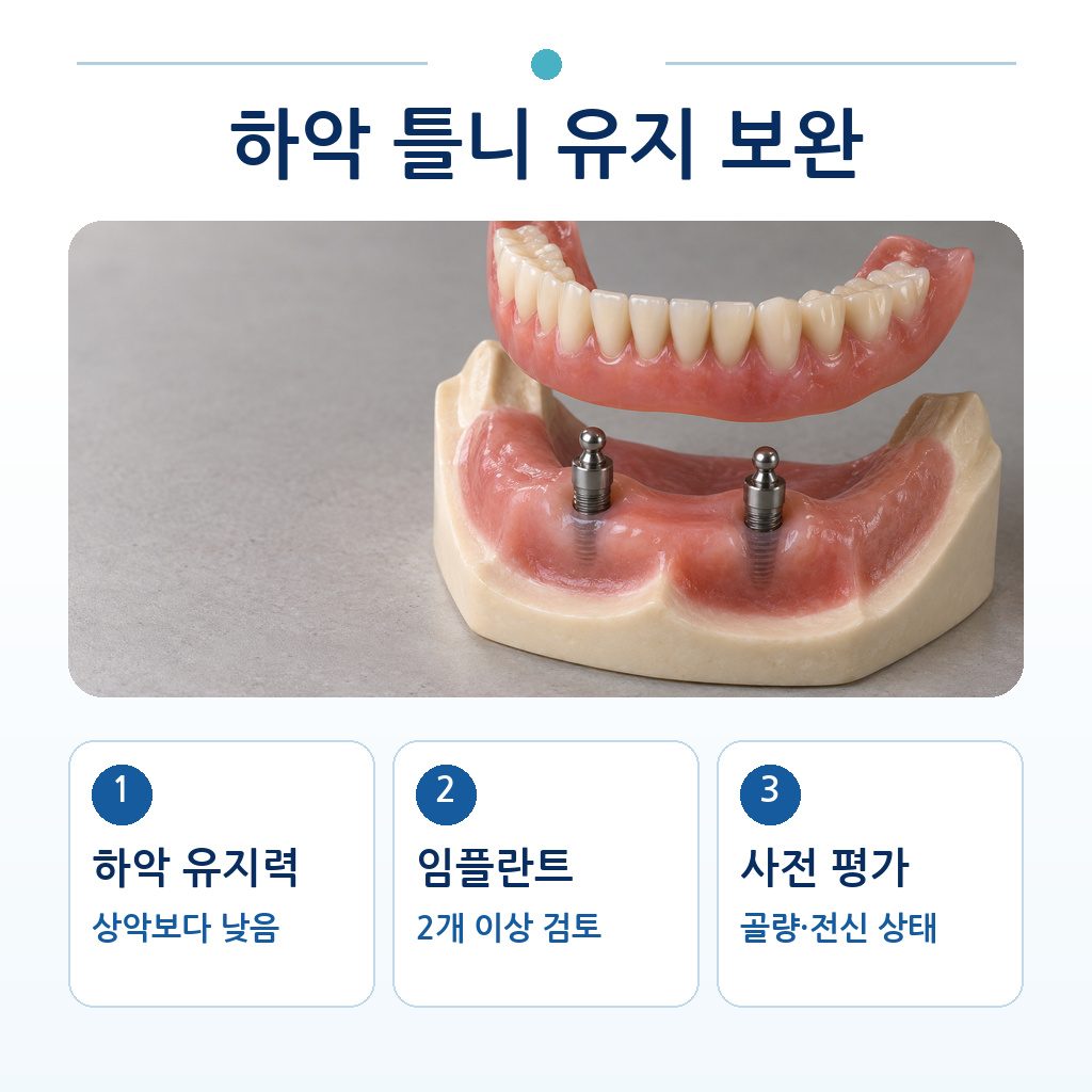 하악 전방부 임플란트 2개에 틀니를 연결해 유지력을 보완하는 방식을 보여 주는 그림