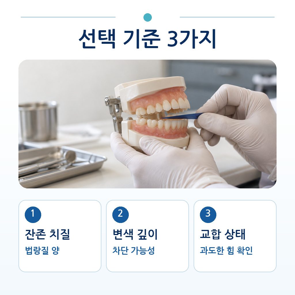 잔존 치질, 변색 깊이, 교합 상태 세 가지 선택 기준을 교합 검사 장면과 함께 정리한 그림